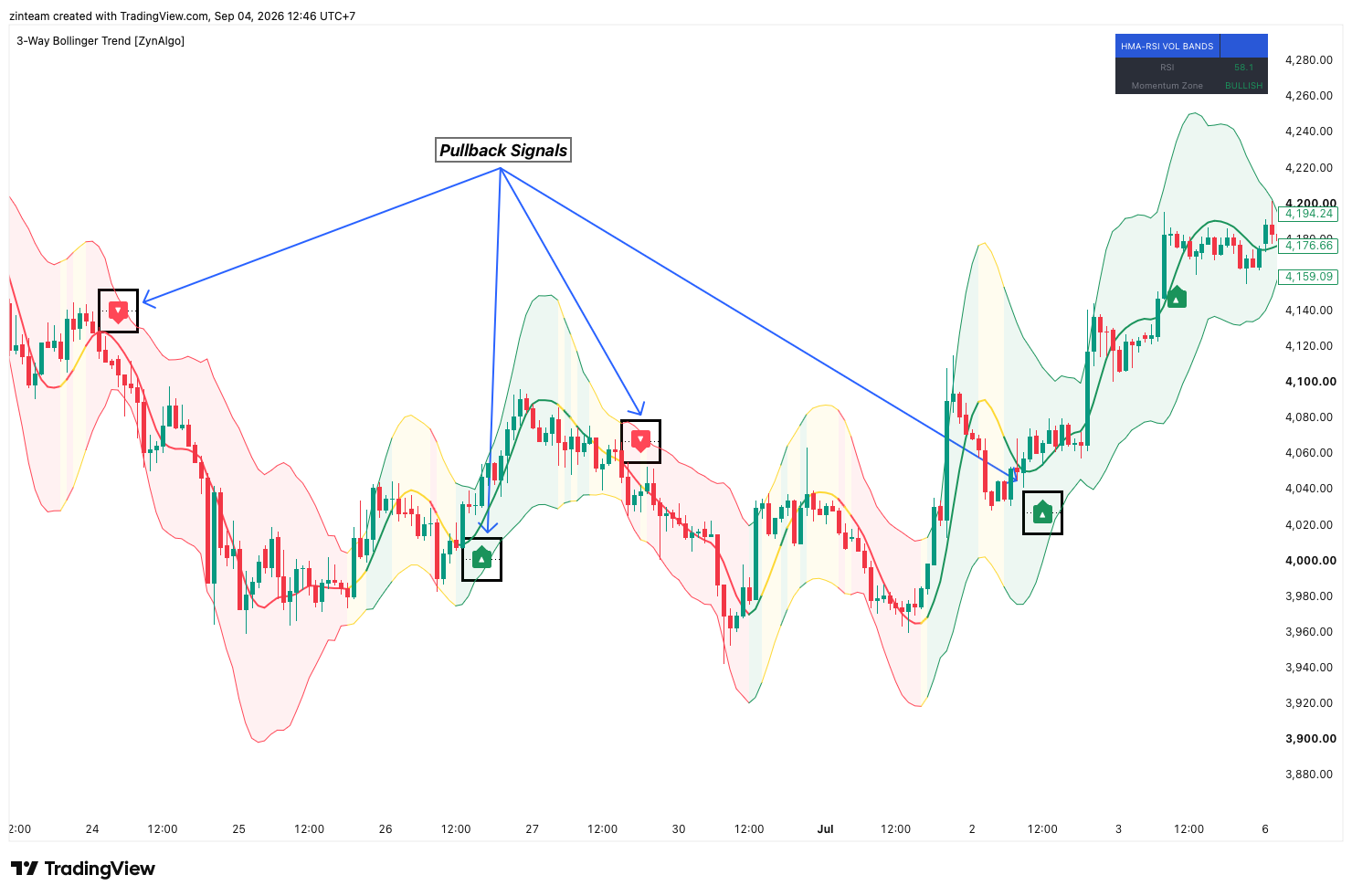 Pullback anatomy